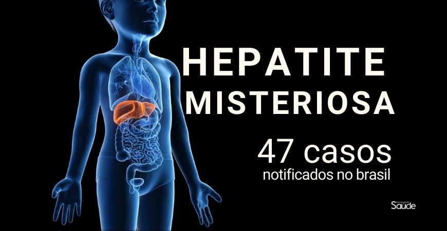 Capa do artigo